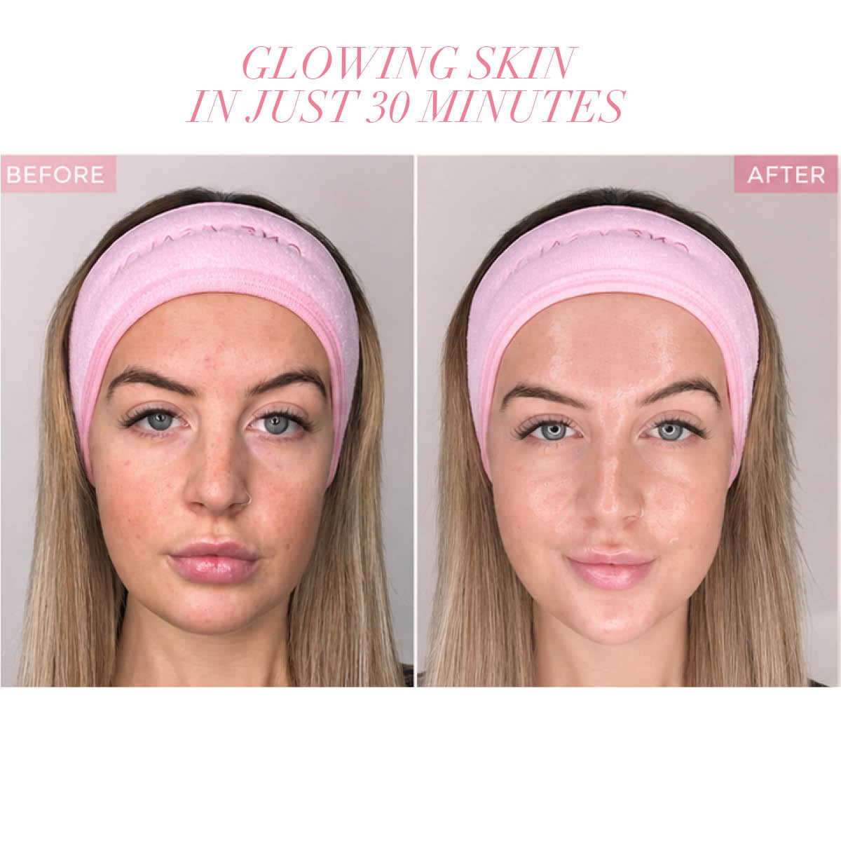 Brightening Wrapping Peel-Off Mask with Collagen | 100ml Kit x 20 Pack - LASH V