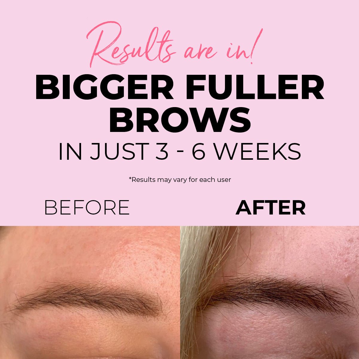 Eyebrow Growth Serum . - LASH V